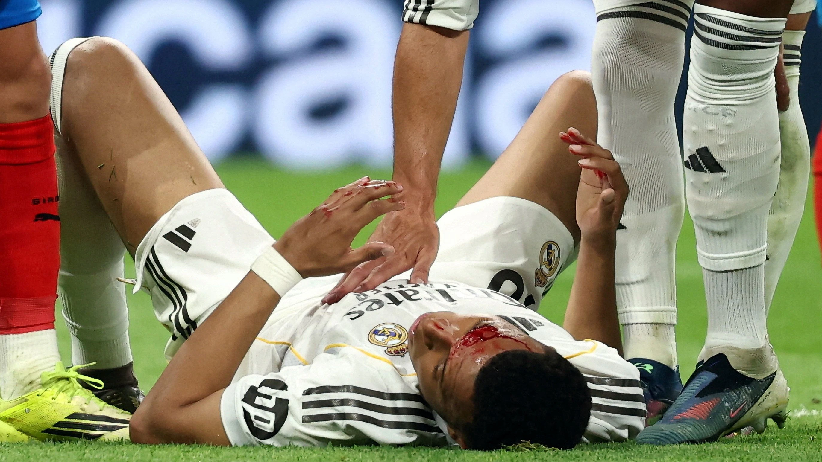 Real Madrid und Star Kylian Mbappe liegen am Boden. 