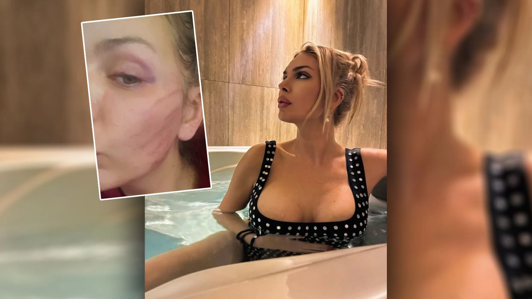 Heute.at - Wunde am Kopf: Freund prügelt Balkan-Star ins Spital