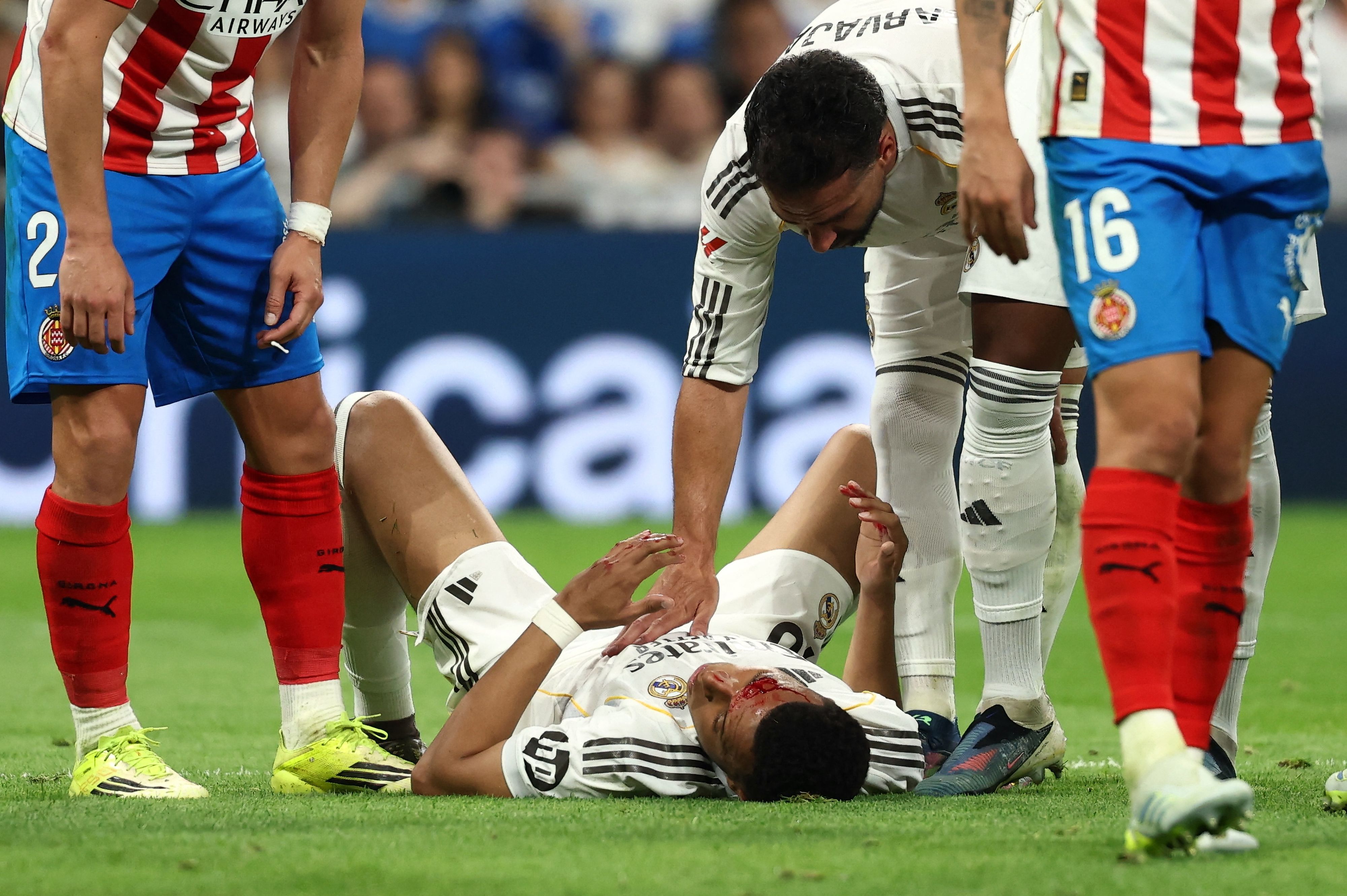 Ein Ellbogencheck im Spiel gegen Girona könnte Mbappe den Bayern-Einsatz kosten.