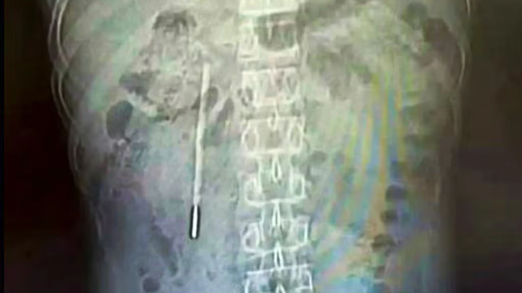 Heute.at - Ärzte untersuchen 32-Jährigen – heftig, was sie finden