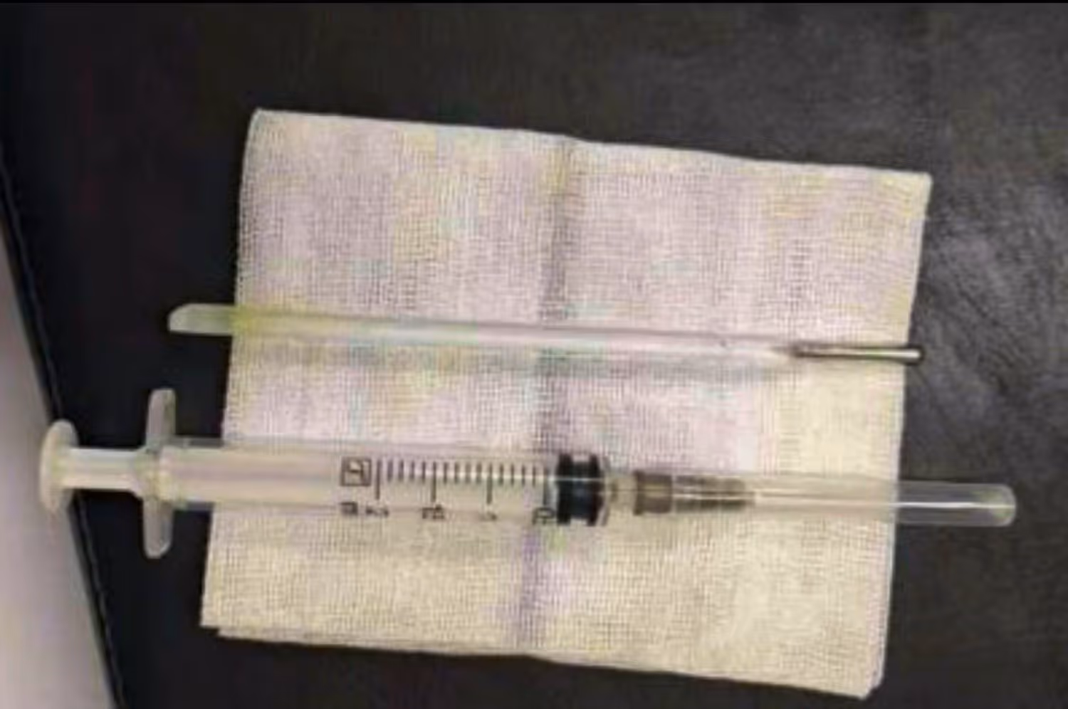 Der 32-jährige Patient erzählte, bereits 20 Jahre lang mit dem Thermometer im Bauch zu leben.