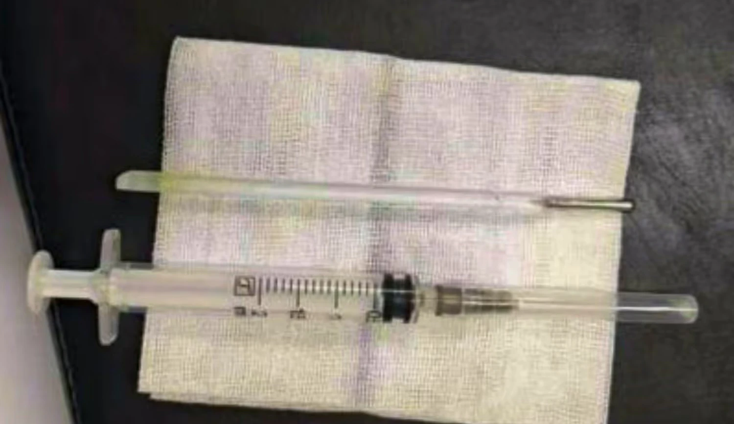 Mann lebte 20 Jahre lang mit Thermometer im Bauch