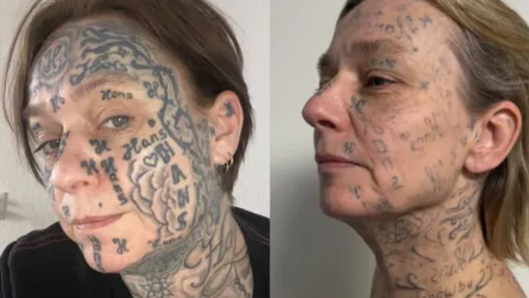 Heute.at - Ex zwingt Frau zu 250 Hans-Tattoos am ganzen Körper