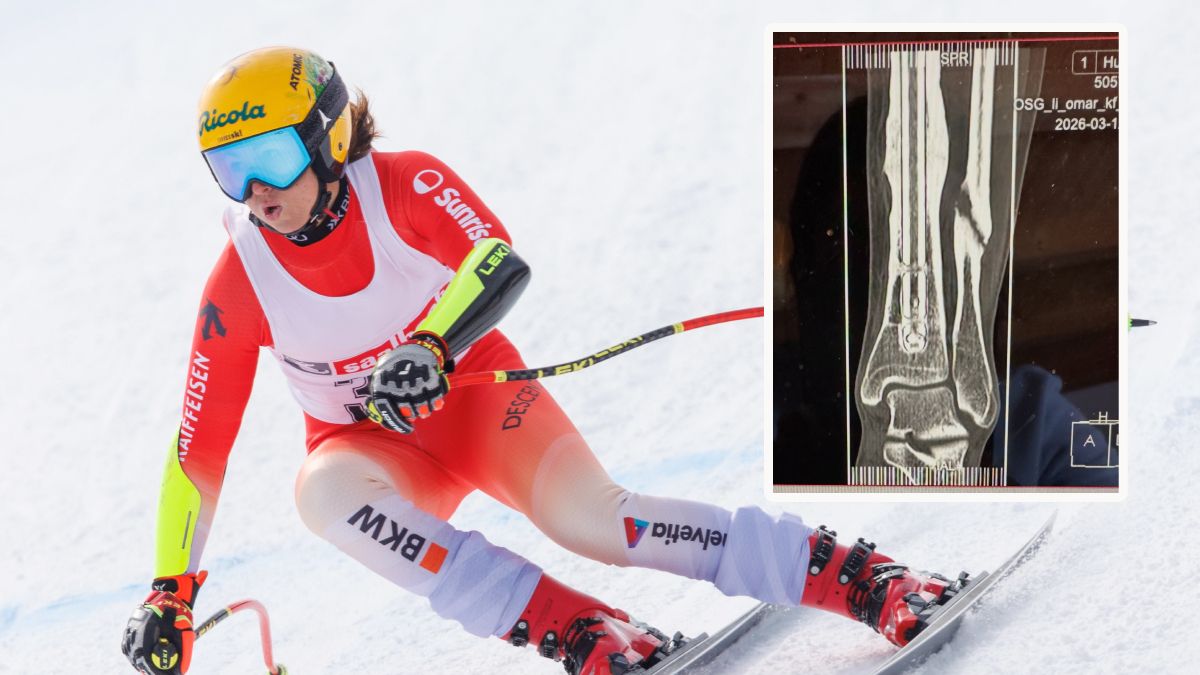 Laura Huber und ihr verletztes Bein.