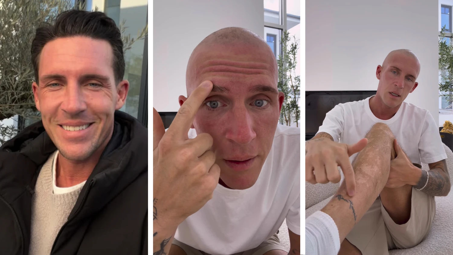 Influencer Tobias Wolf hat plötzlich keine Haare mehr.