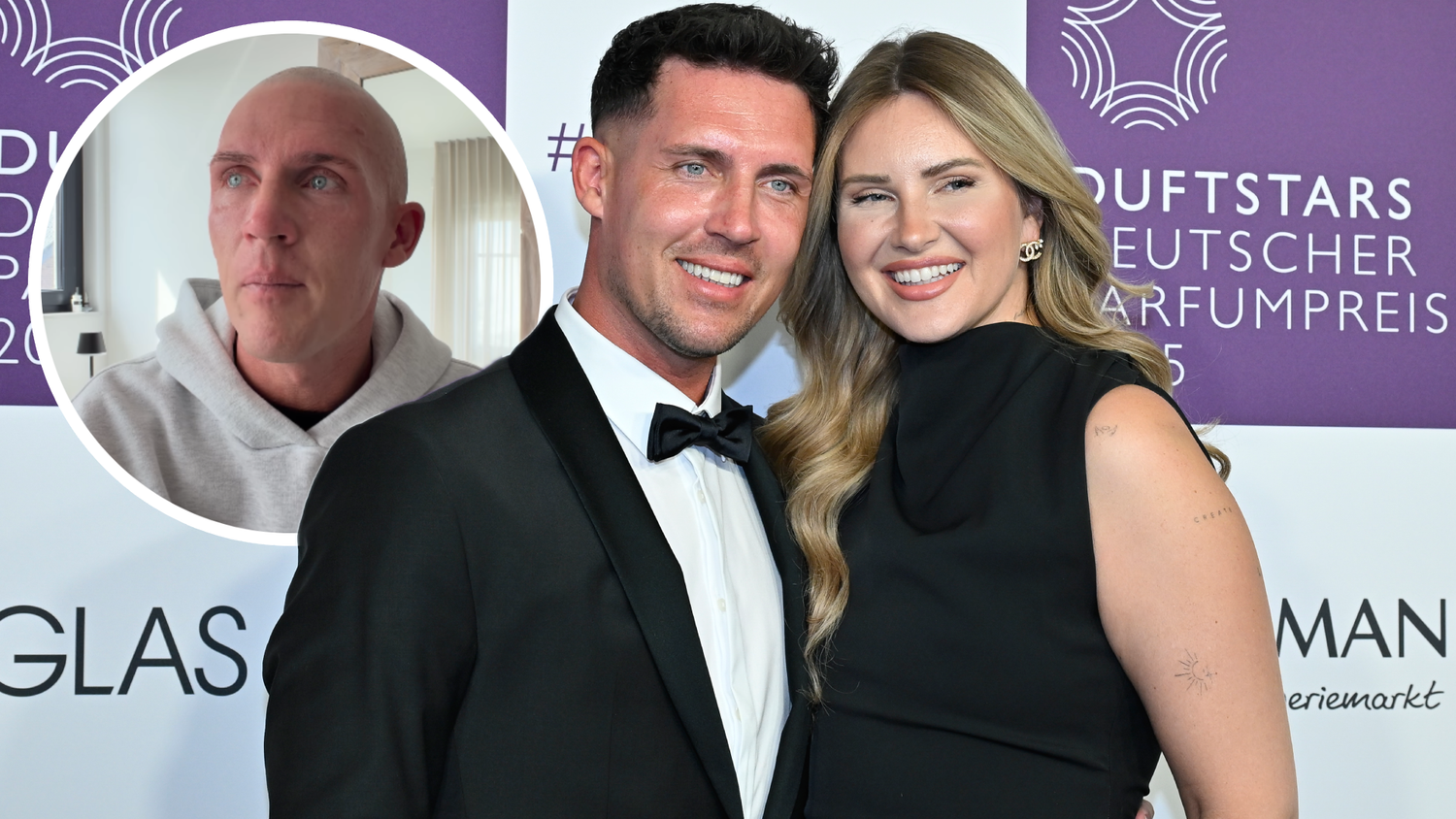 Heute.at - Schock: Influencer verliert in zwei Wochen alle Haare