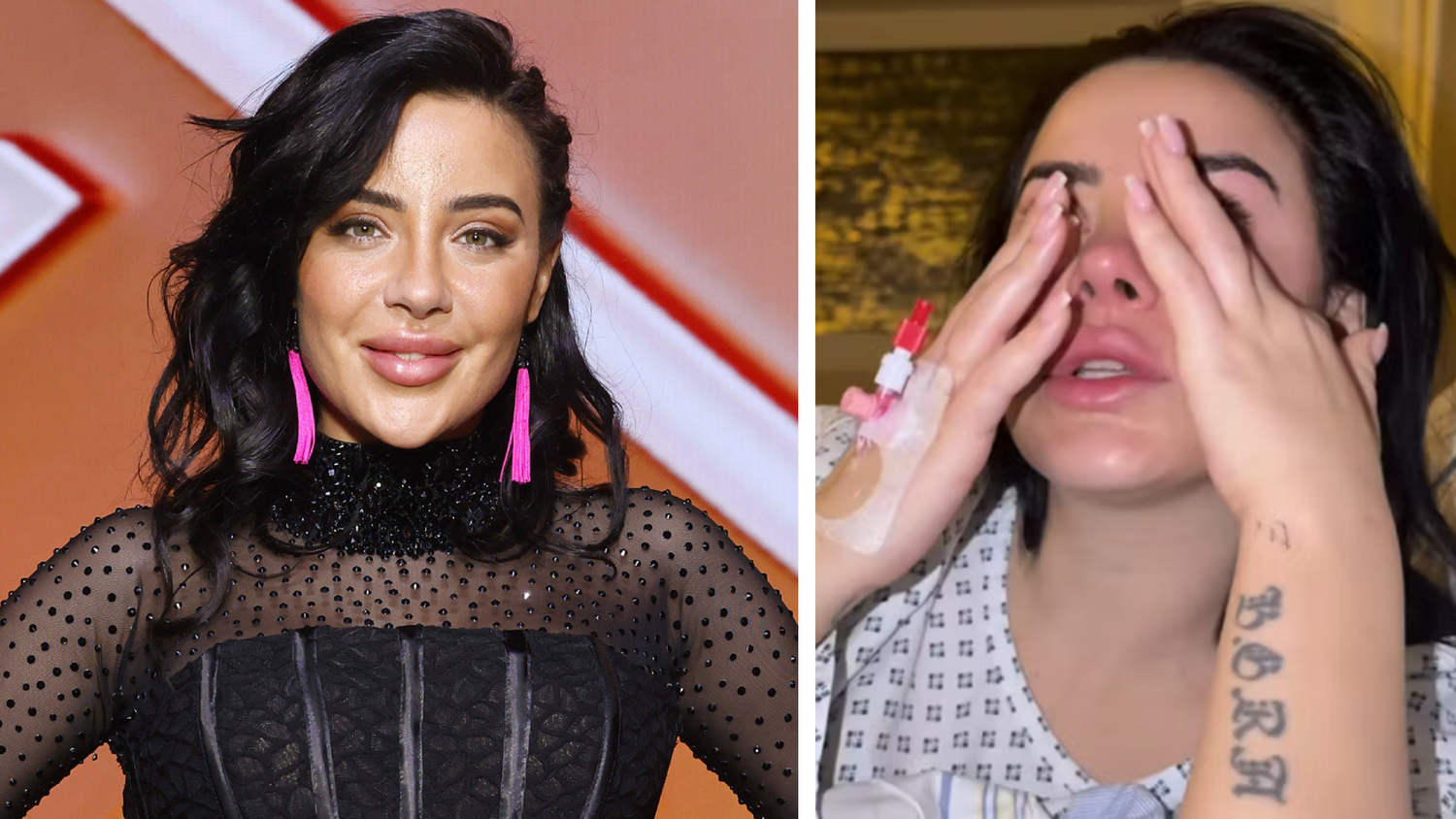 Leyla wurde von einem Affen gebissen.