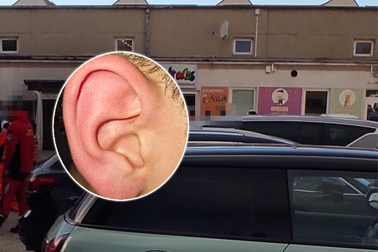 Das Ohr des Neunjährigen war nach dem Schlag sichtlich gerötet.