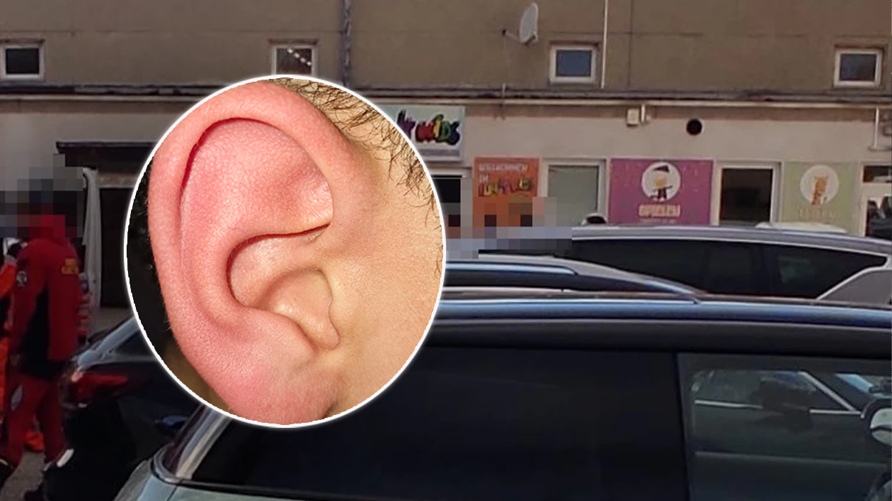 Das Ohr des Neunjährigen war nach dem Schlag sichtlich gerötet.