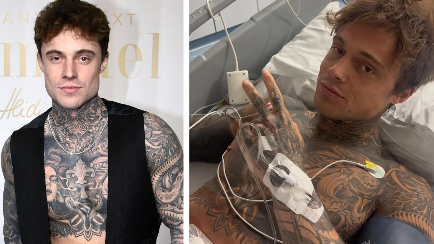 Heute.at - GNTM-Star kämpft mit schweren Folgen nach Messerattacke