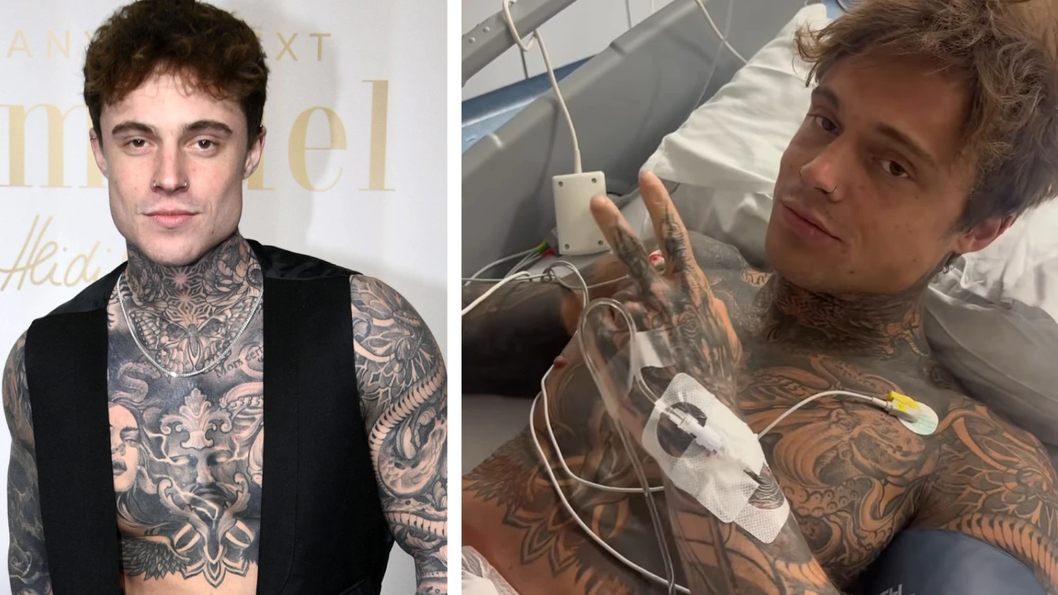 Heute.at - GNTM-Star kämpft mit schweren Folgen nach Messerattacke