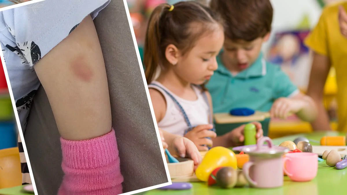 In einem Kindergarten in Wien-Meidling kam es zu mehreren Verletzungen, Anna S. nahm ihr Kind raus.