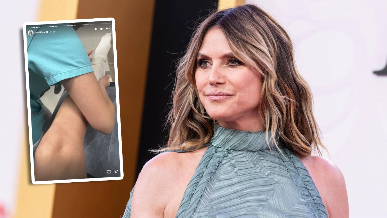 Schwere Verletzung - "Gar nicht lustig": Heidi Klum landet in Notaufnahme