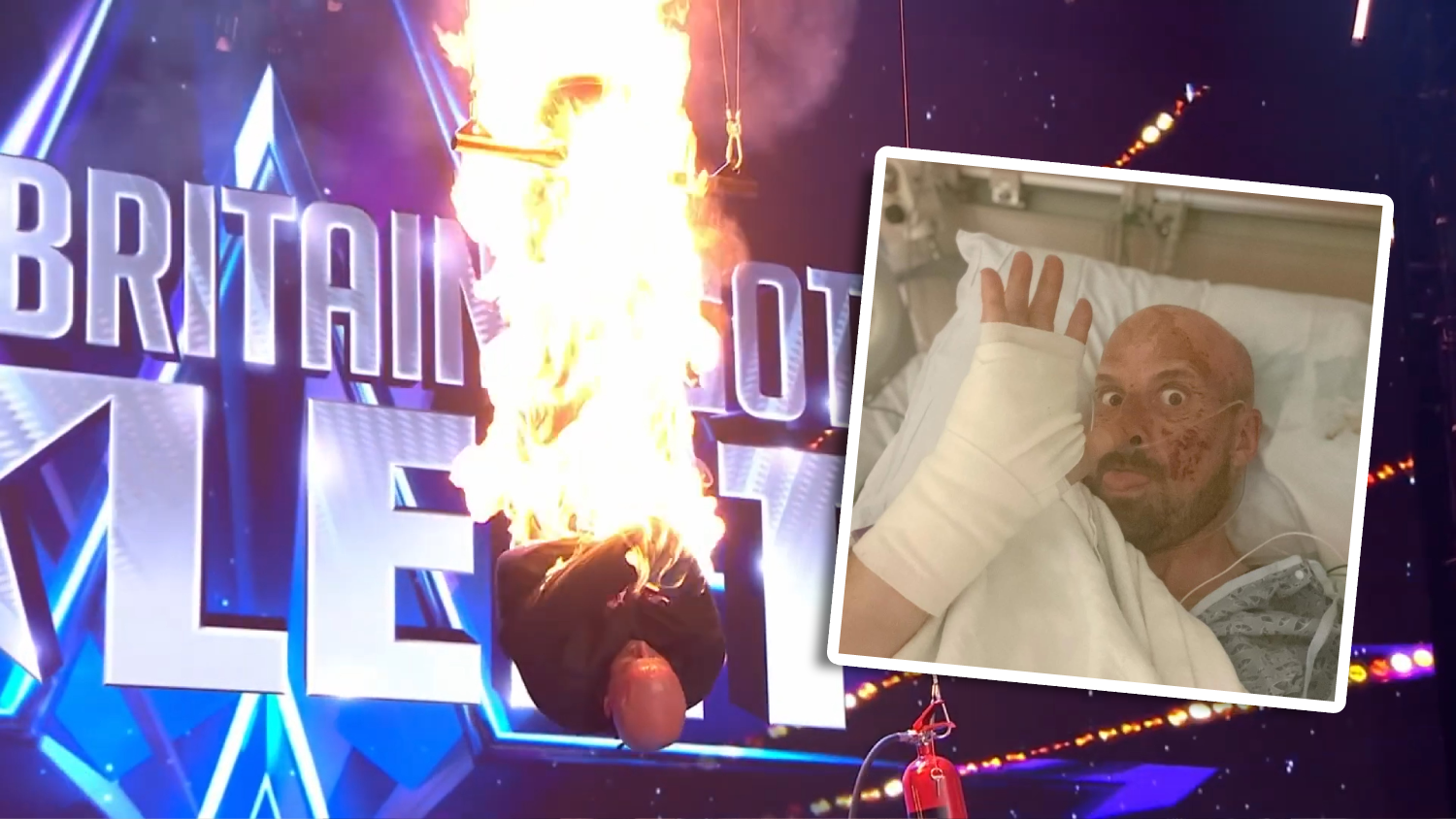 Magier und Stuntman Jonathan Goodwin nach seinem Horror-Unfall in der Klinik.