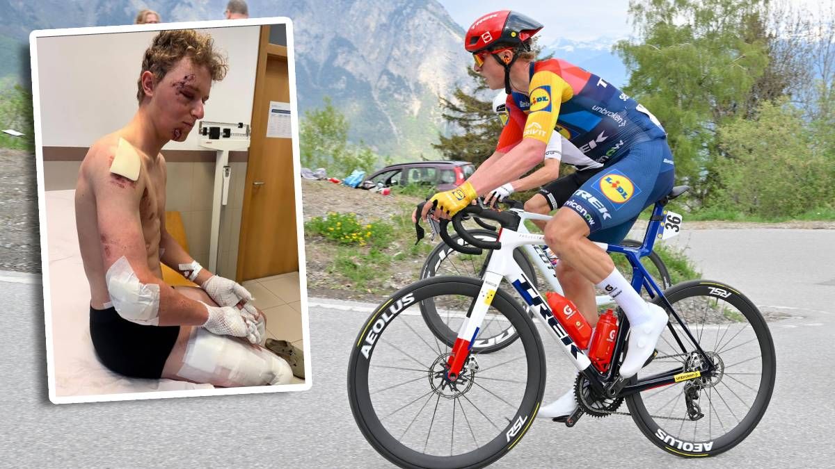 Albert PHilipsen zeigt seine schweren Verletzungen. 