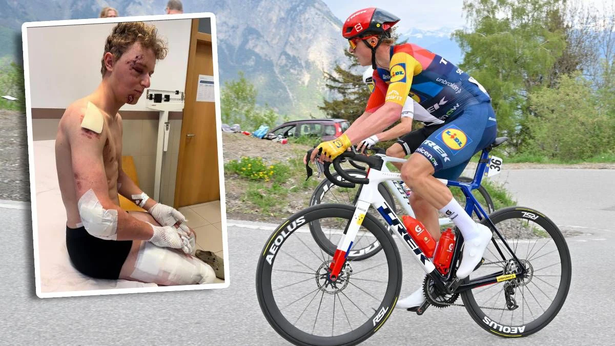 Albert PHilipsen zeigt seine schweren Verletzungen. 