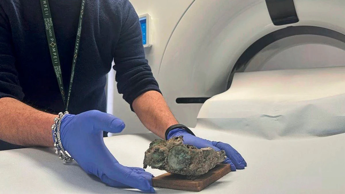 Ein Behälter offenbarte mittels CT-Scans Werkzeuge, die einem Arzt nützlich gewesen sein konnten.