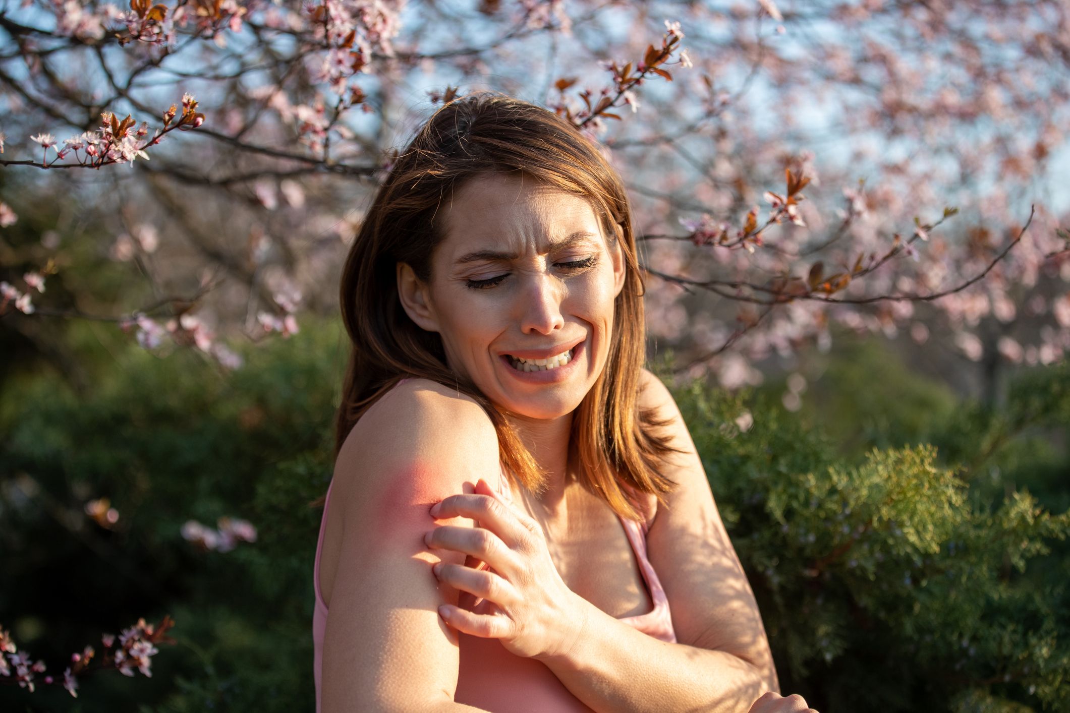 Angst für Mücken und Bienen haben wir nicht nur wegen der Stiche.