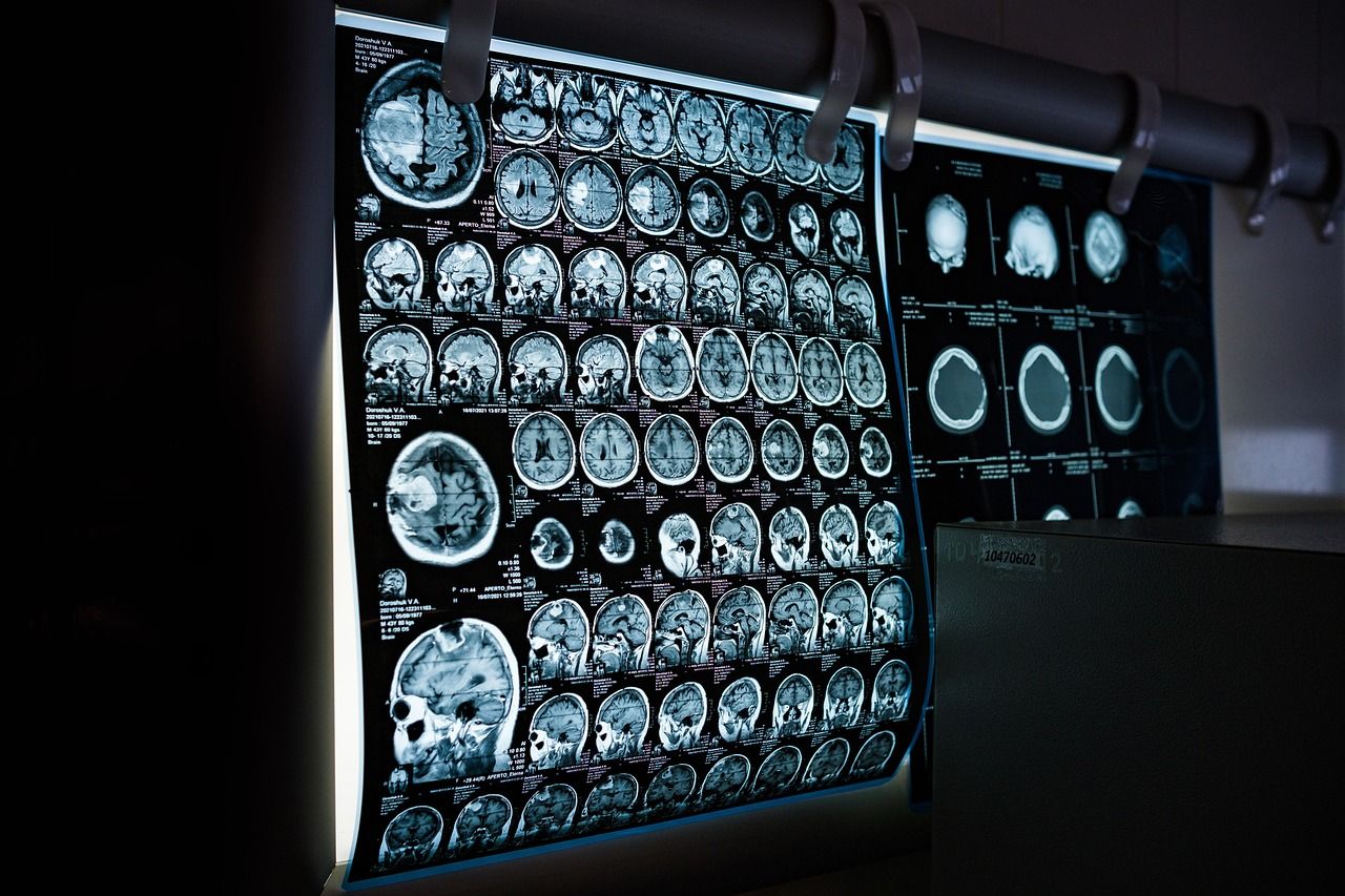 Gehirn-Diagnostik mittels MRT- und CT-Scan