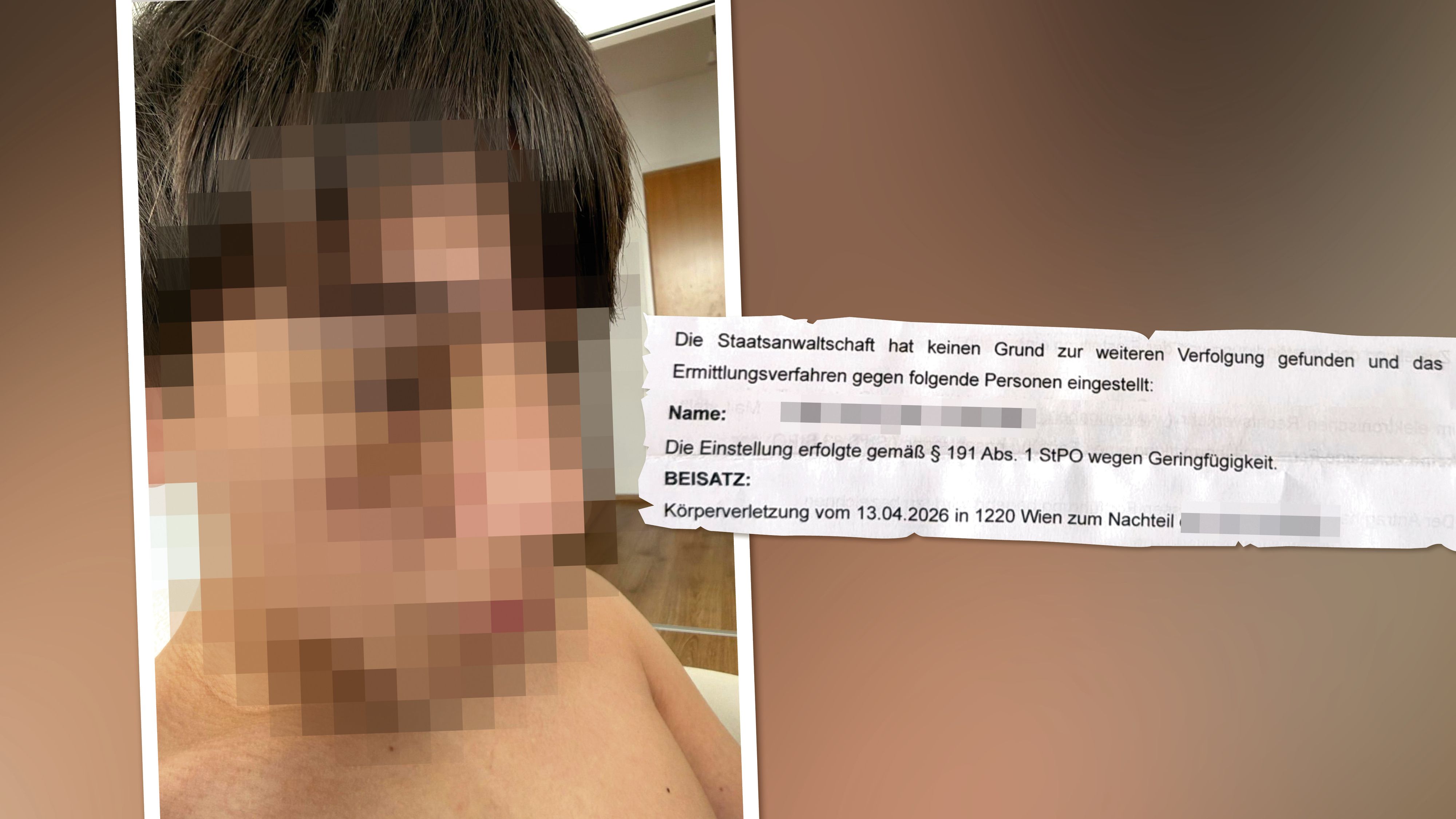 Der 14-Jährige erlitt eine Jochbeinprellung.