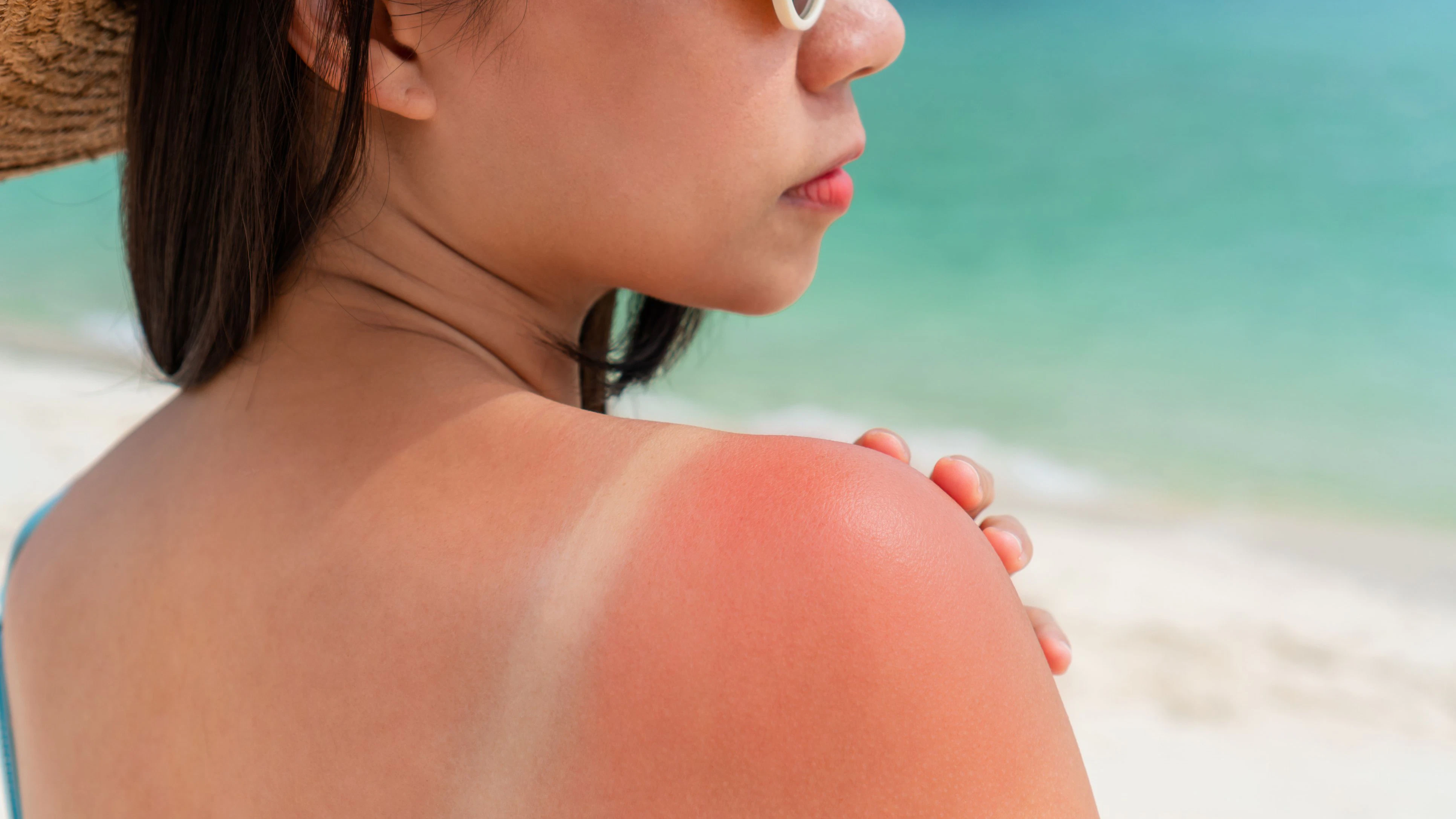 Heute.at - Sonnenschutz-Check – diese 7 Fehler machen fast alle!