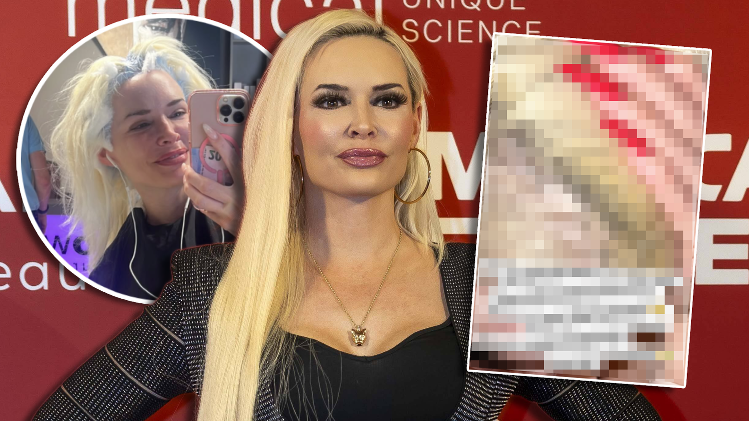 Heute.at - Glatzenberger – Daniela macht Schock-Geständnis