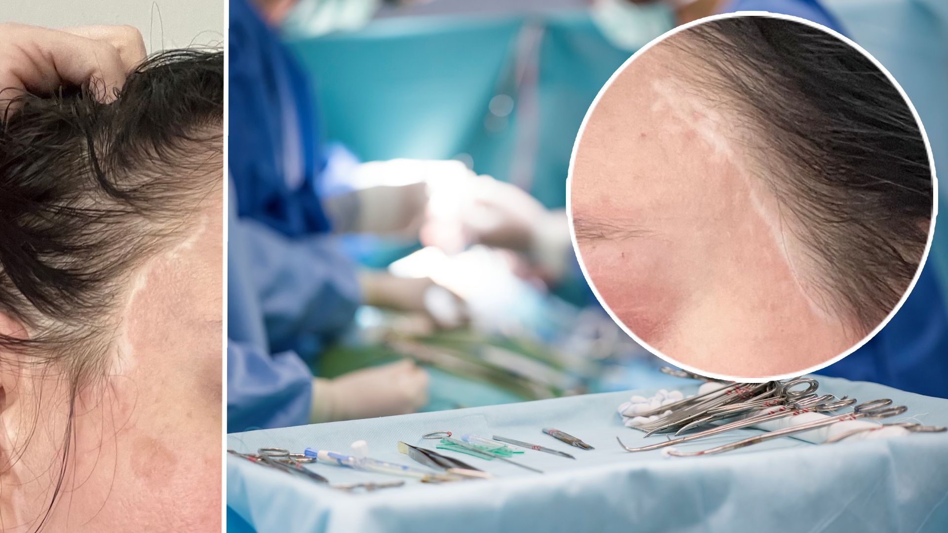 Heute.at - Frau nach Beauty-OP: Leben ist aus den Fugen geraten