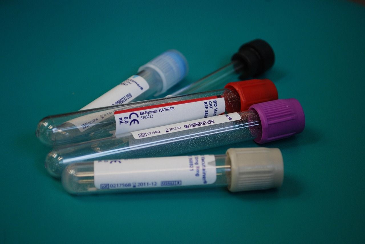 Labordiagnose bei Virusuntersuchung