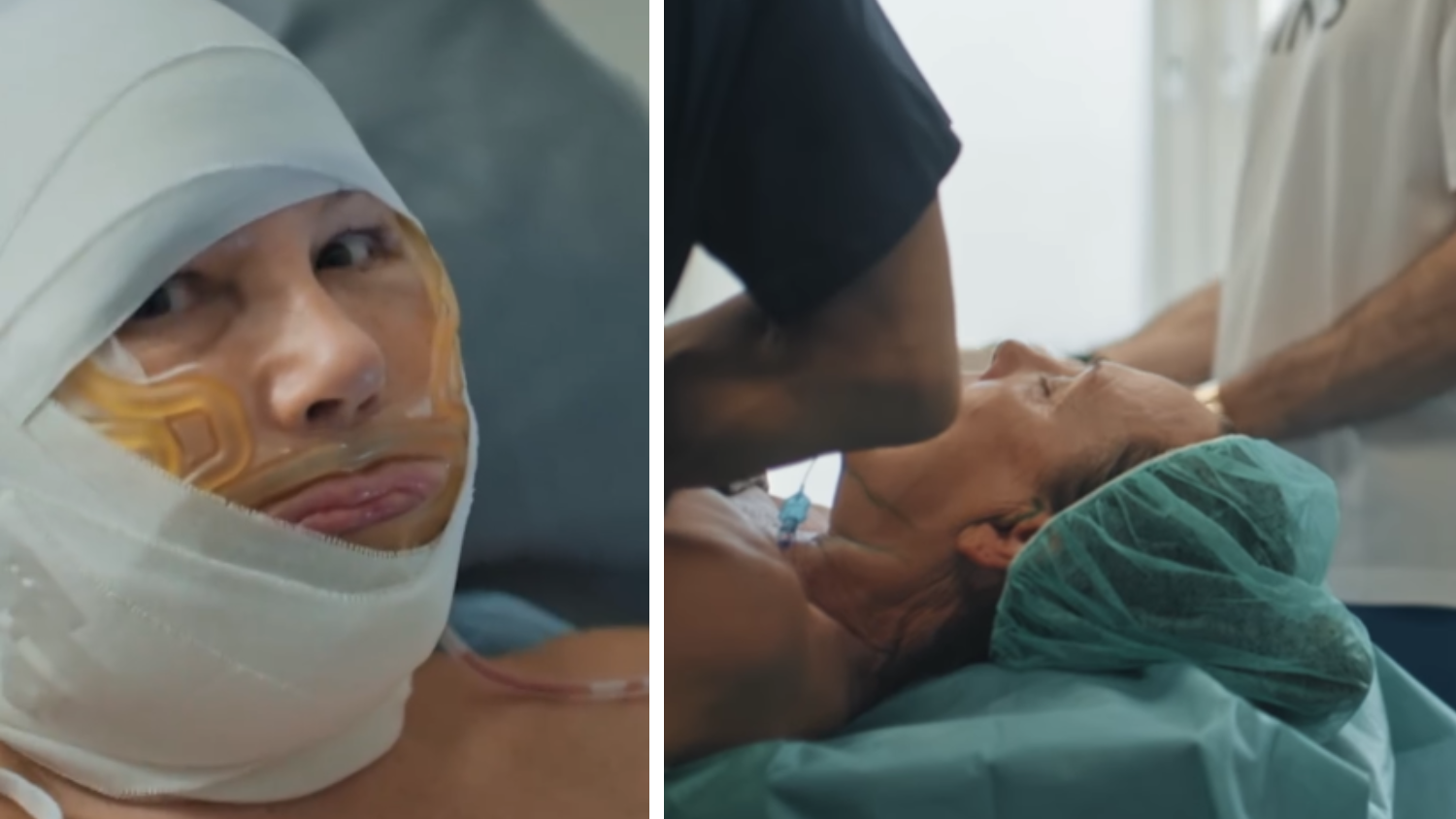 Heute.at - Schock-Fotos! Ochsenknecht zeigt sich nach Beauty-OP