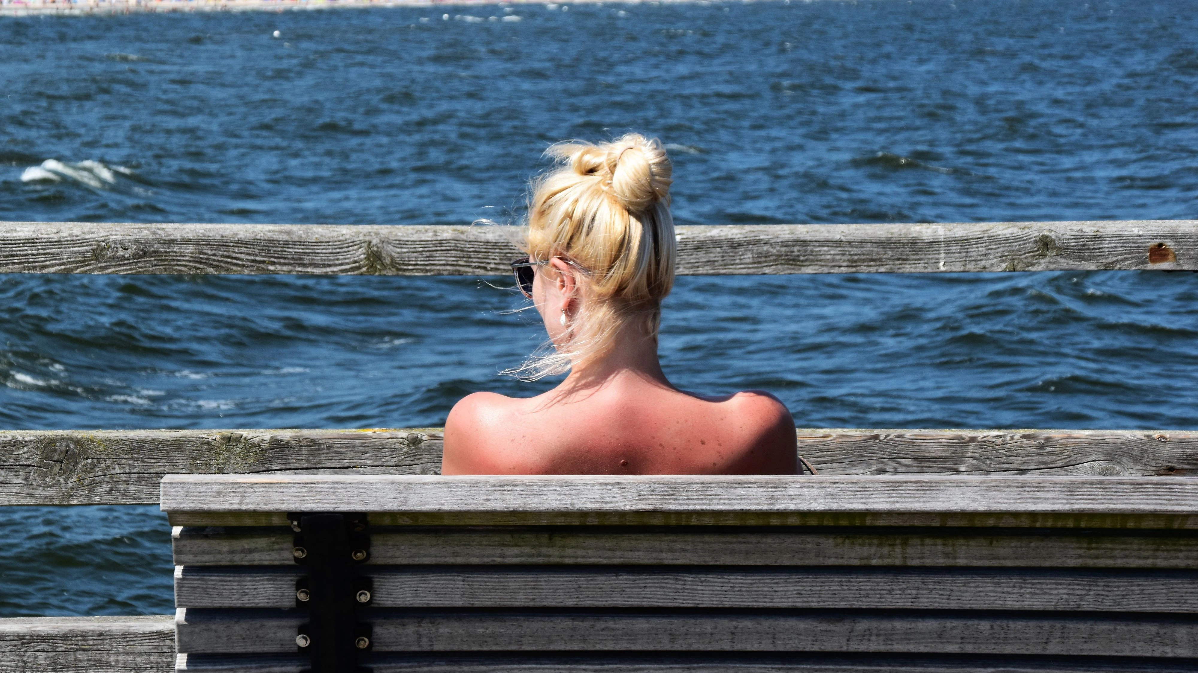 Sonnenbrand...