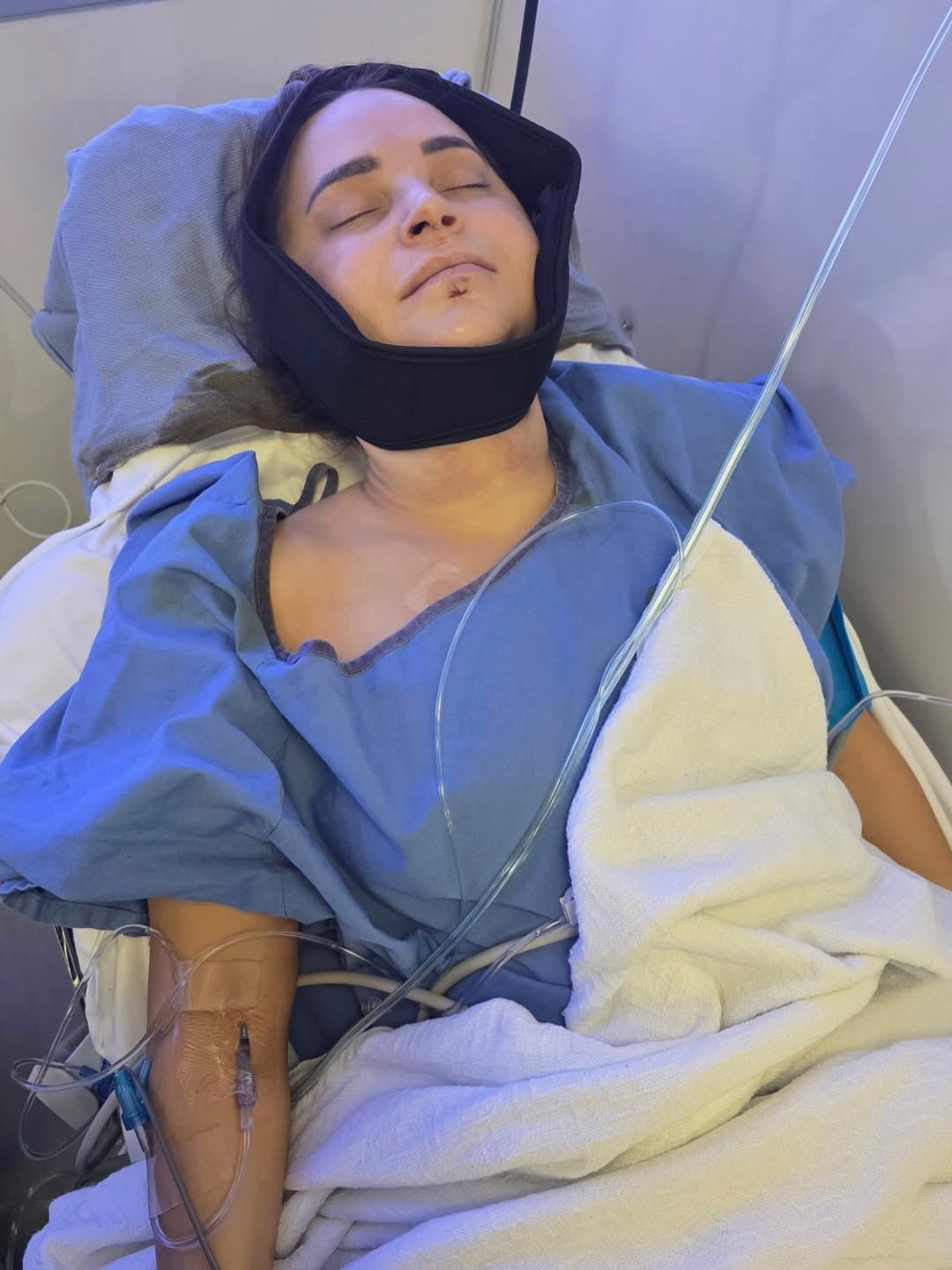 YouTube-Star Rosanna Pansino zertrümmert sich Kiefer und Zähne.