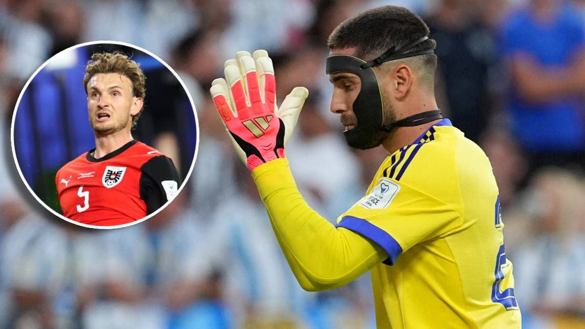 Auch Algeriens Tormann Luca Zidane hat einen Kieferbruch erlitten. 