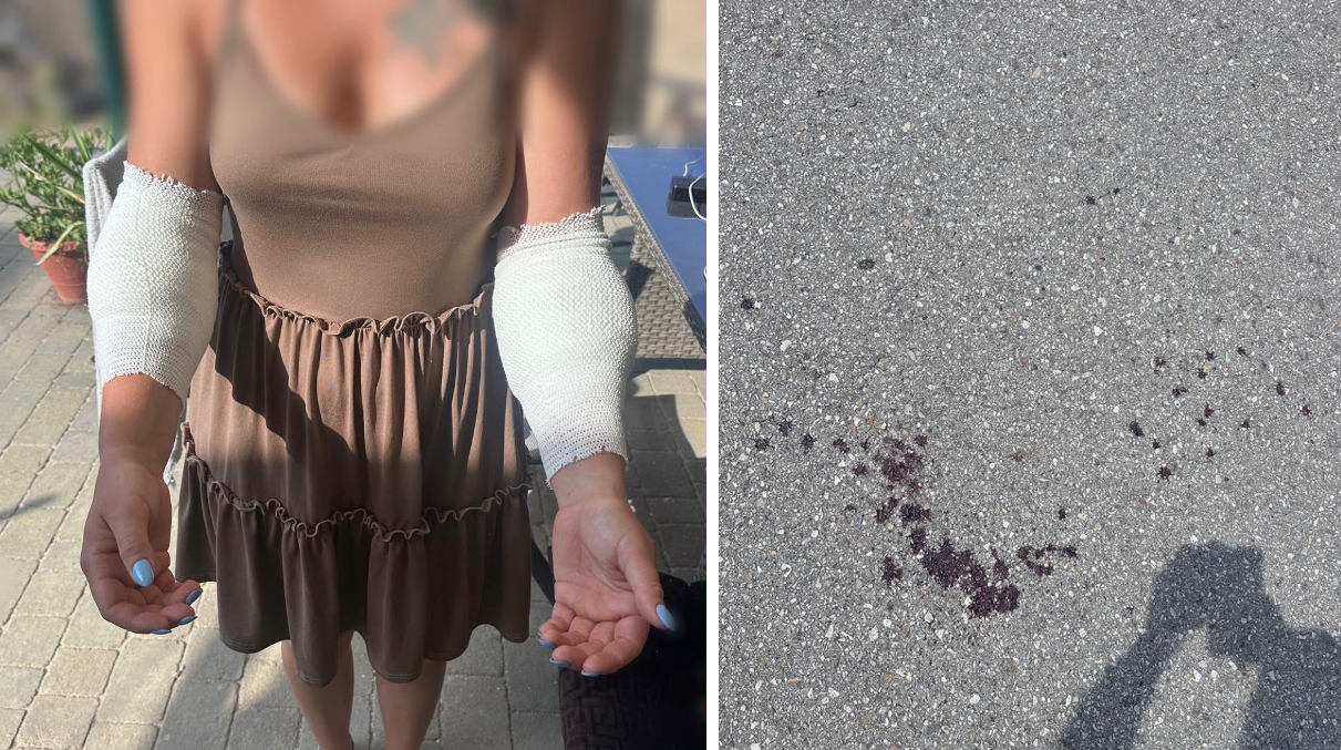 Martina C. kam mit vier Bisswunden ins Krankenhaus nach St. Pölten.