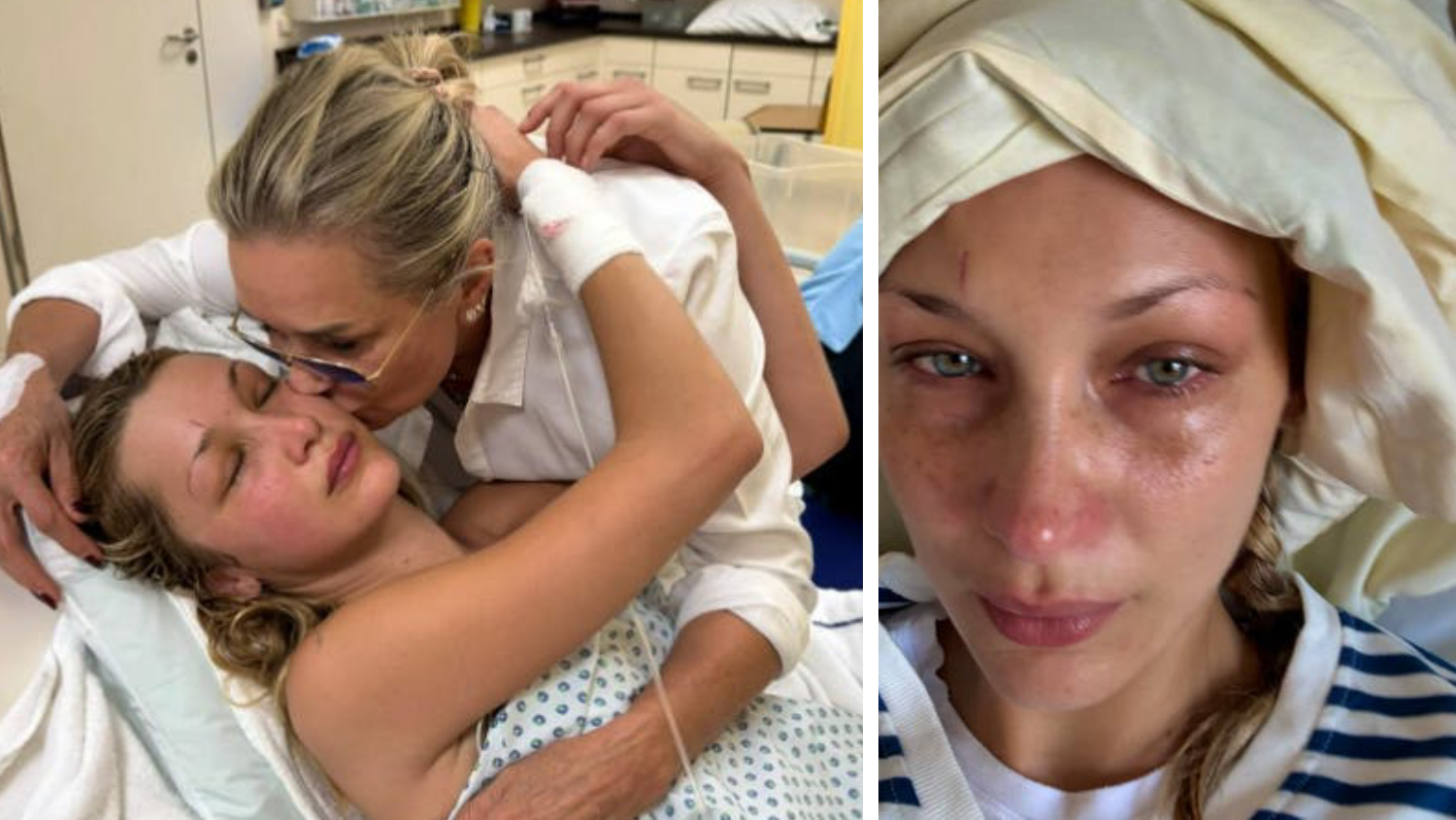 Bella Hadid leidet seit Jahren unter Lyme-Borreliose. 
