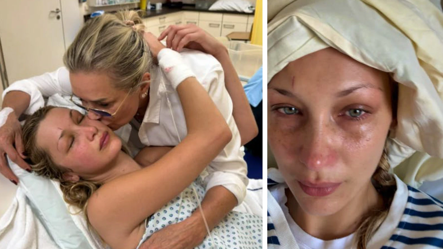 Bella Hadid leidet seit Jahren unter Lyme-Borreliose. 