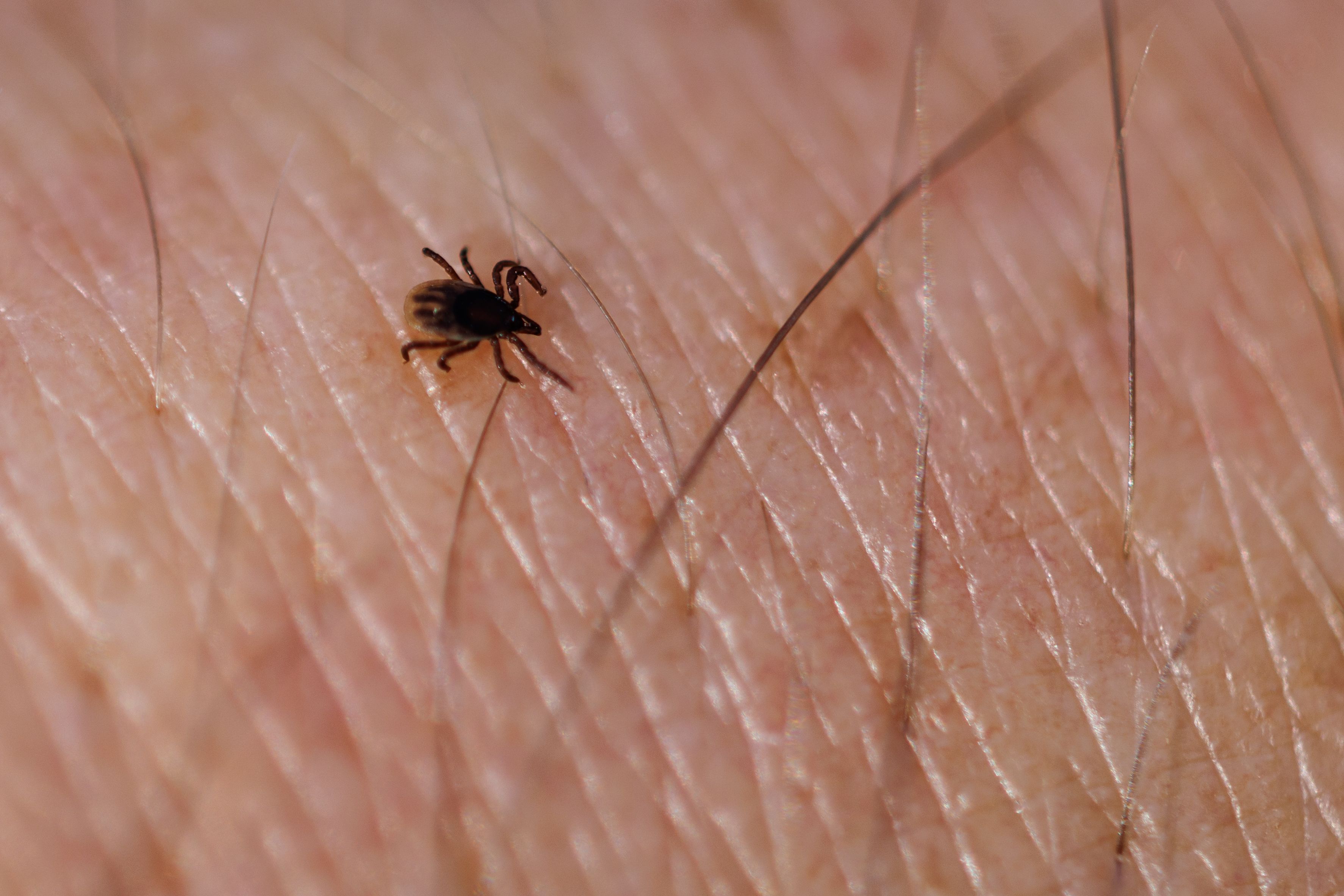 Zecken können die Infektionskrankheit&nbsp;Lyme-Borreliose übertragen.