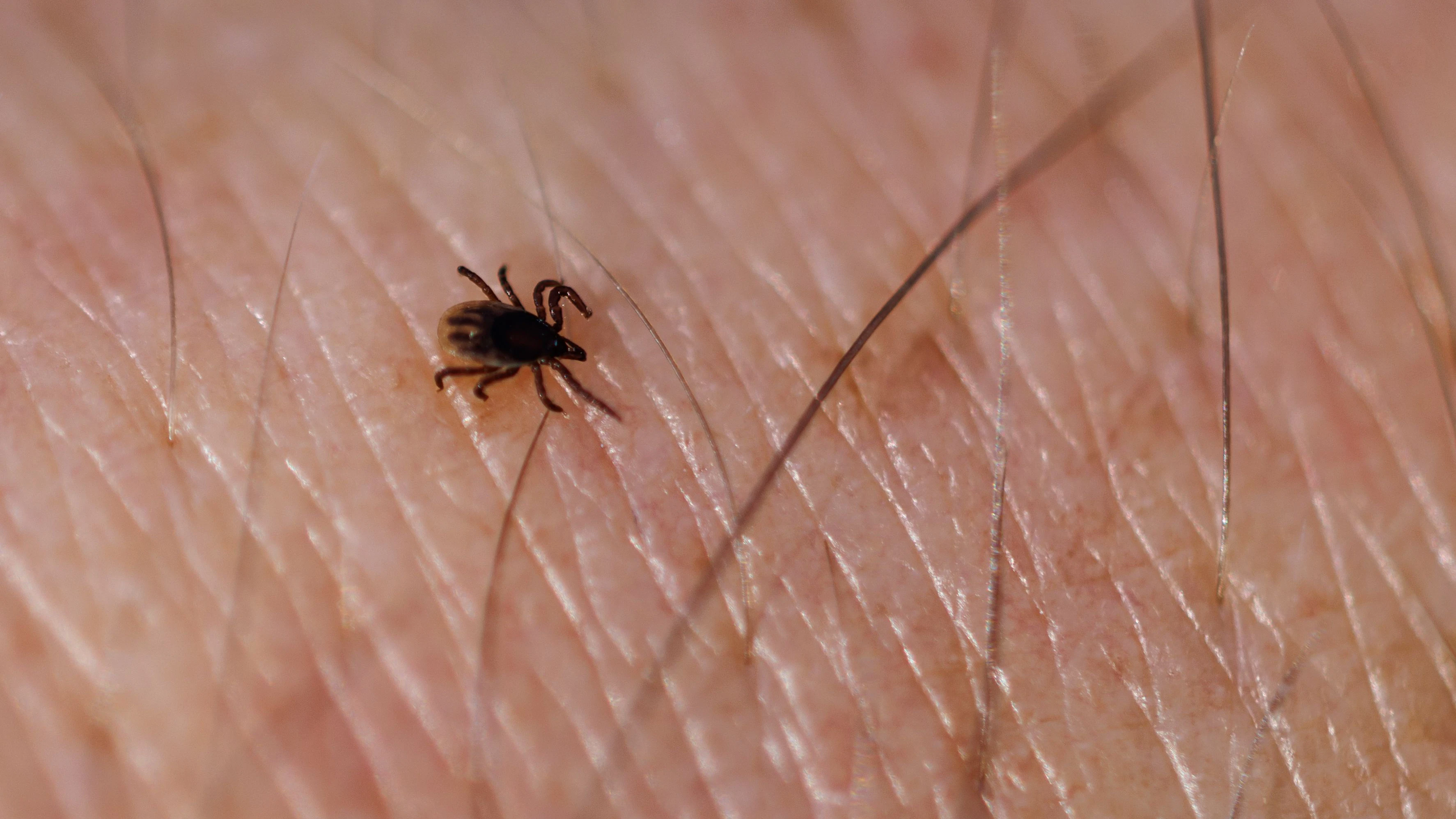 18 June 2026, Lower Saxony, Norden: A tiny tick can be seen on a man's skin in Norden (Lower Saxony, Germany) on June 18, 2026. (Ticks, tick species, tick species, stock image, stock photo, illustration, symbolic photo, illustrative photo, thematic image, general image, thematic photo) Photo: Matthias Balk/dpa