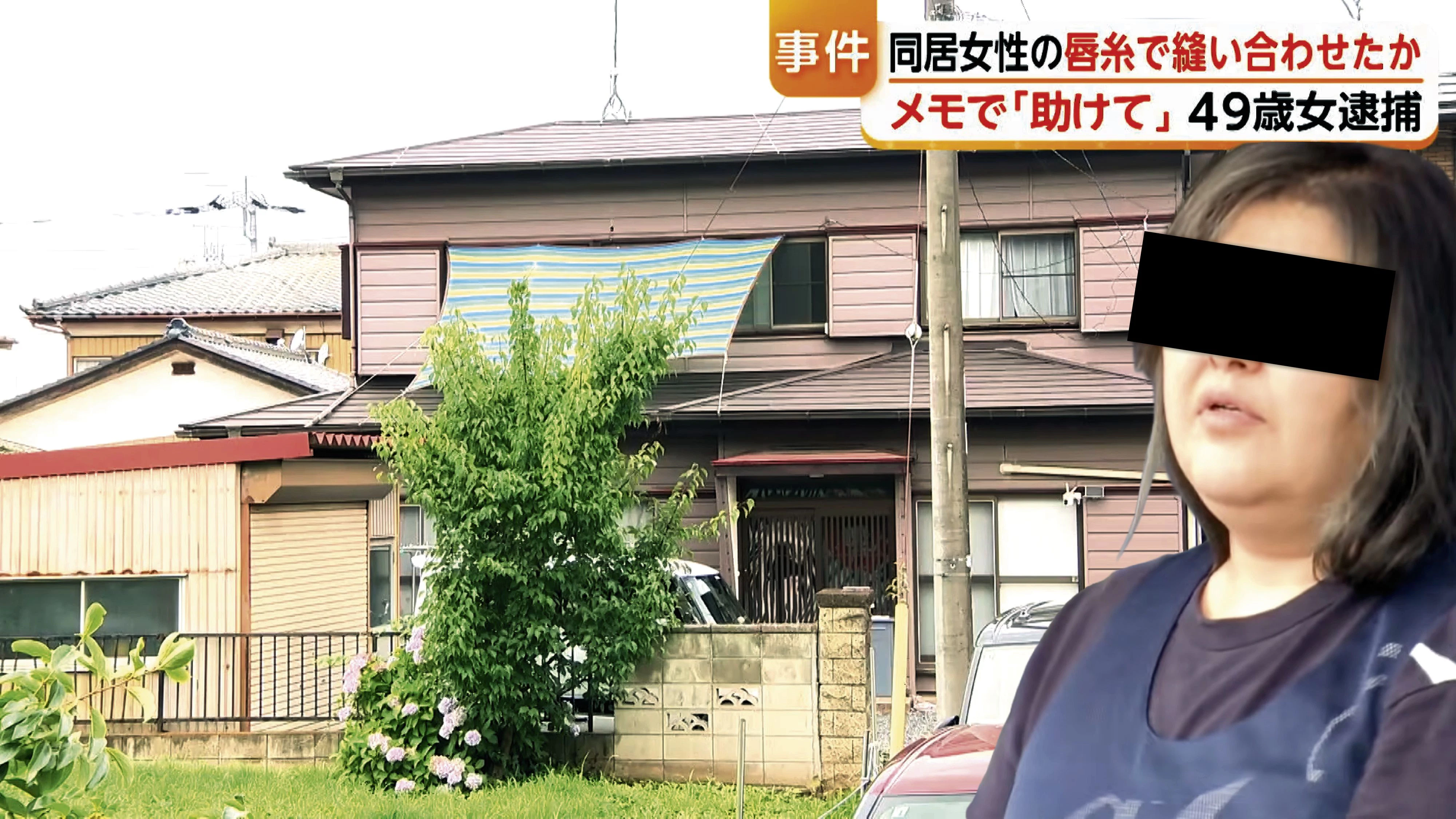 In der japanischen Stadt Koga wurde eine Frau festgenommen, weil sie ihrer Mitbewohnerin den Mund zugenäht hat