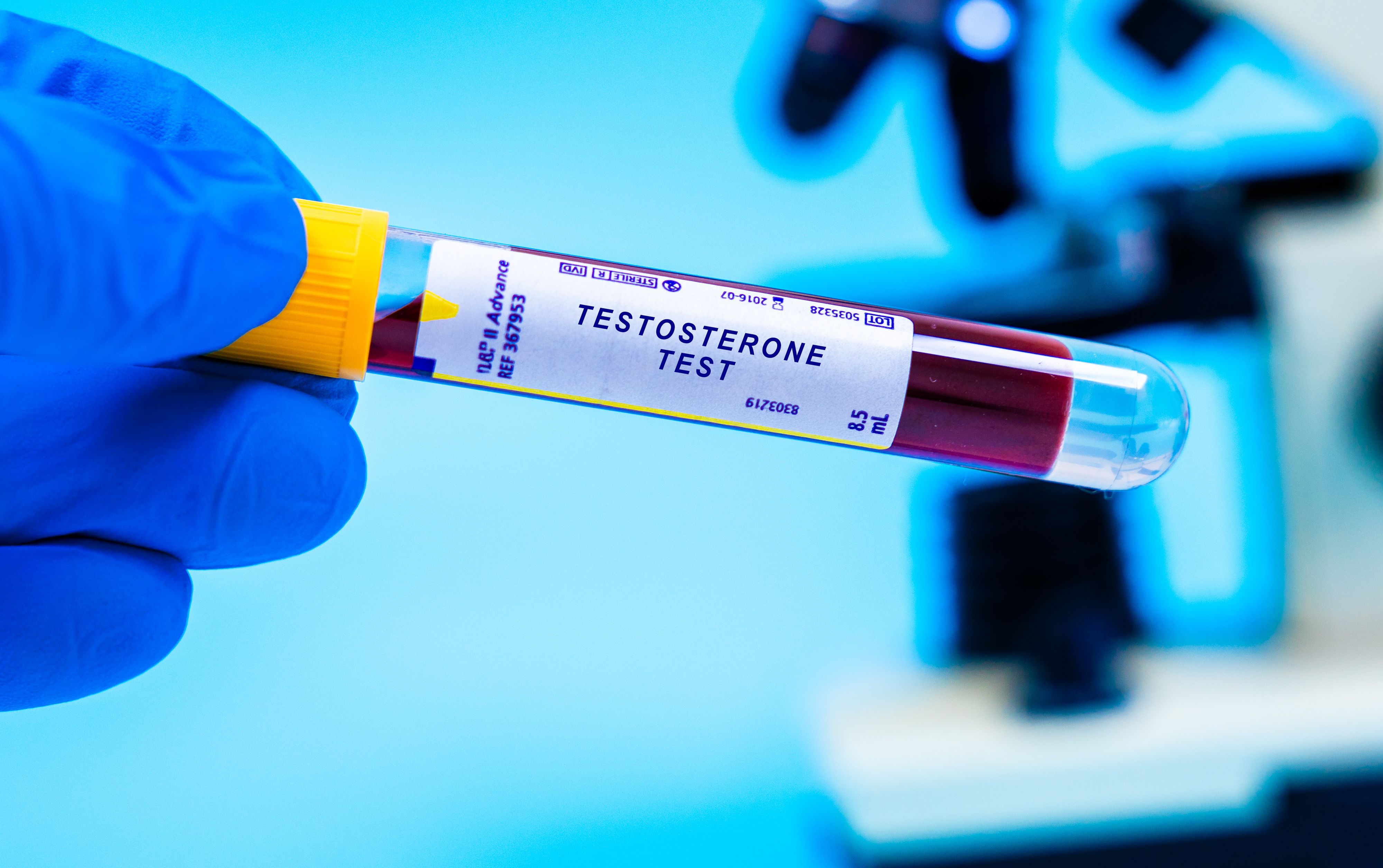 Testosteron-Tests sollen künftig garantieren, dass US-Kämpfer gesünder und leistungsfähiger werden.