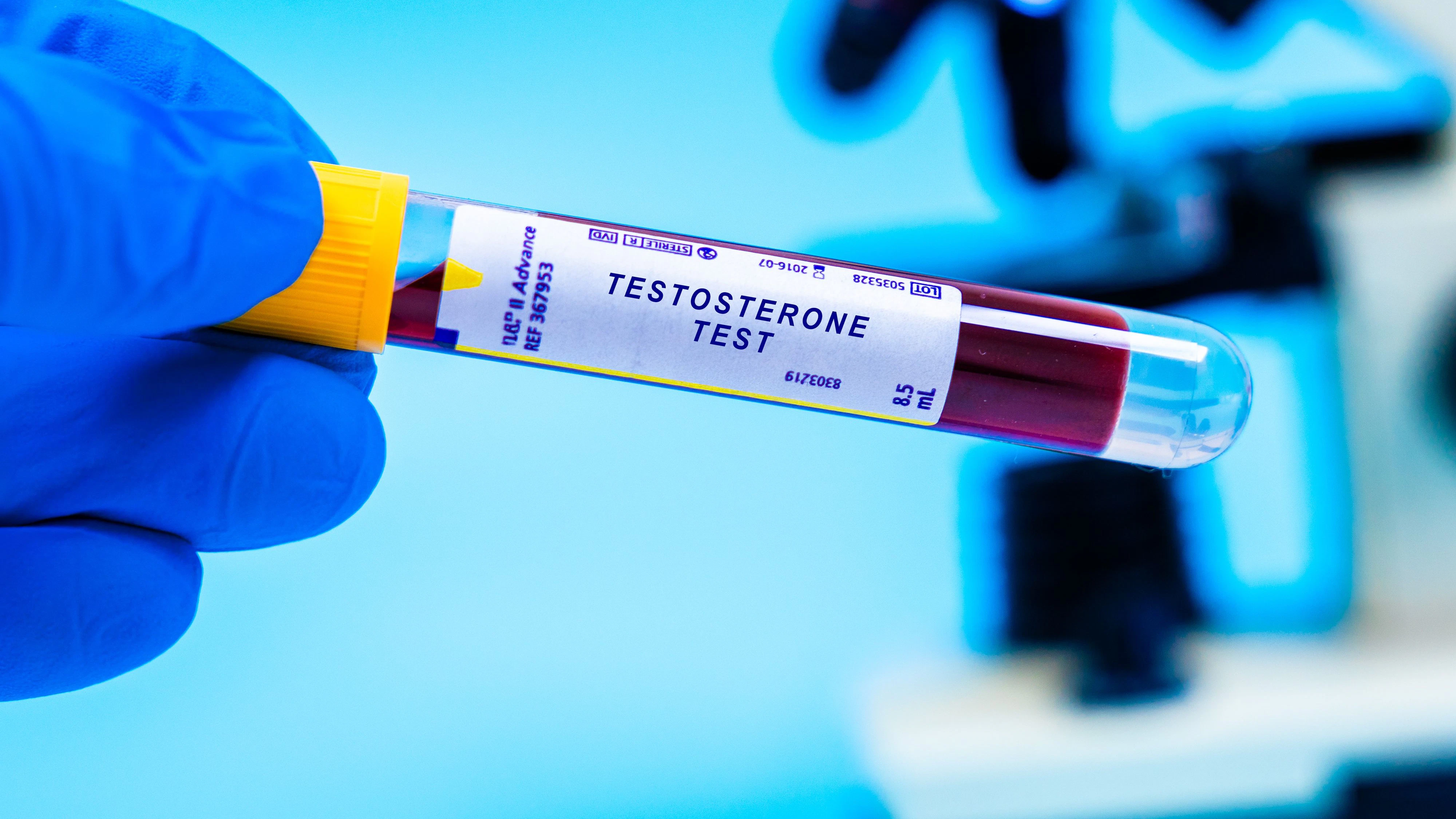 Testosterone blood test. Measures testosterone levels, often abused in sports for performance enhancement.