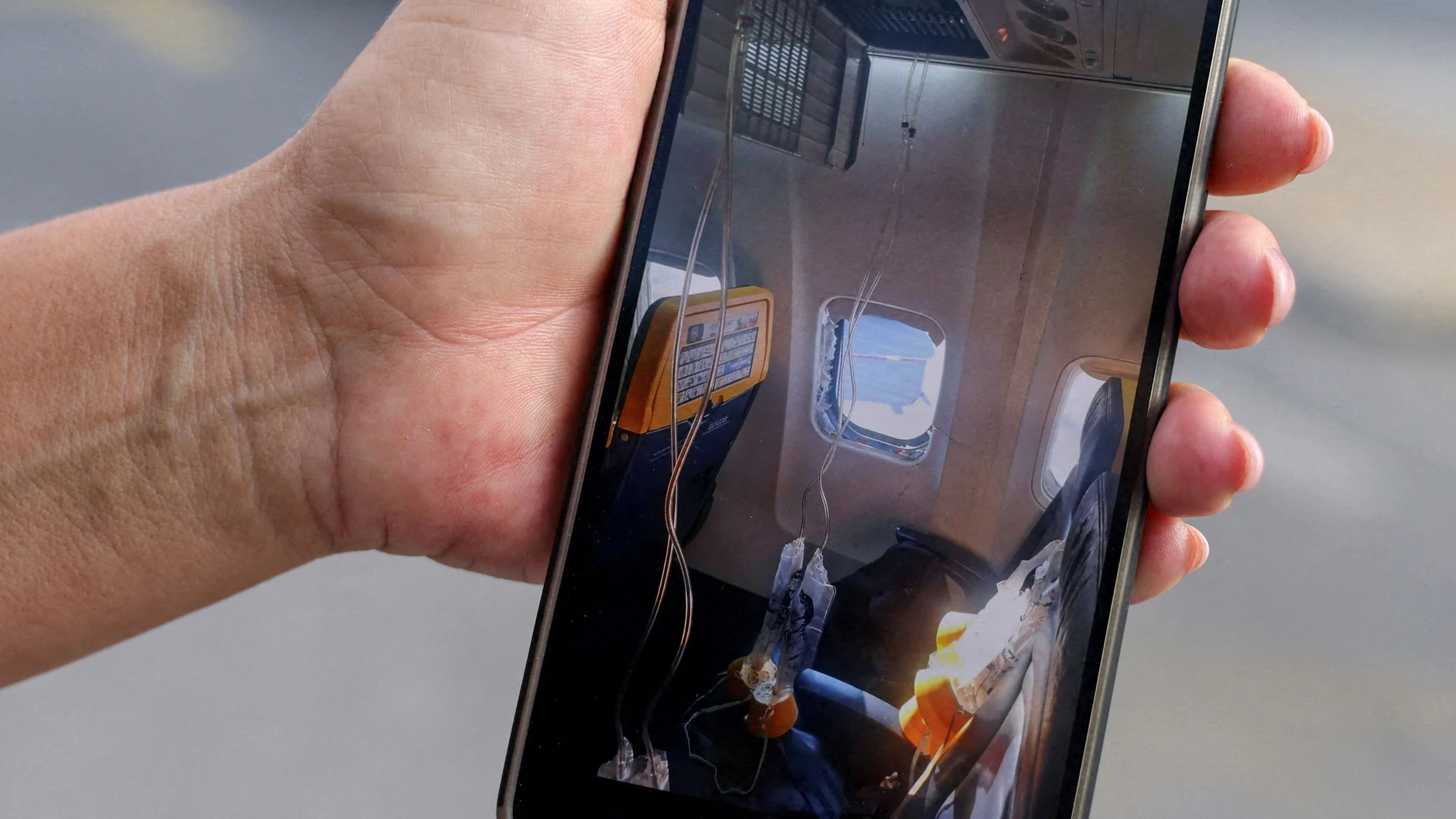 Heute.at - Aus Ryanair-Jet gesaugt – Kopf sah aus wie Schwamm