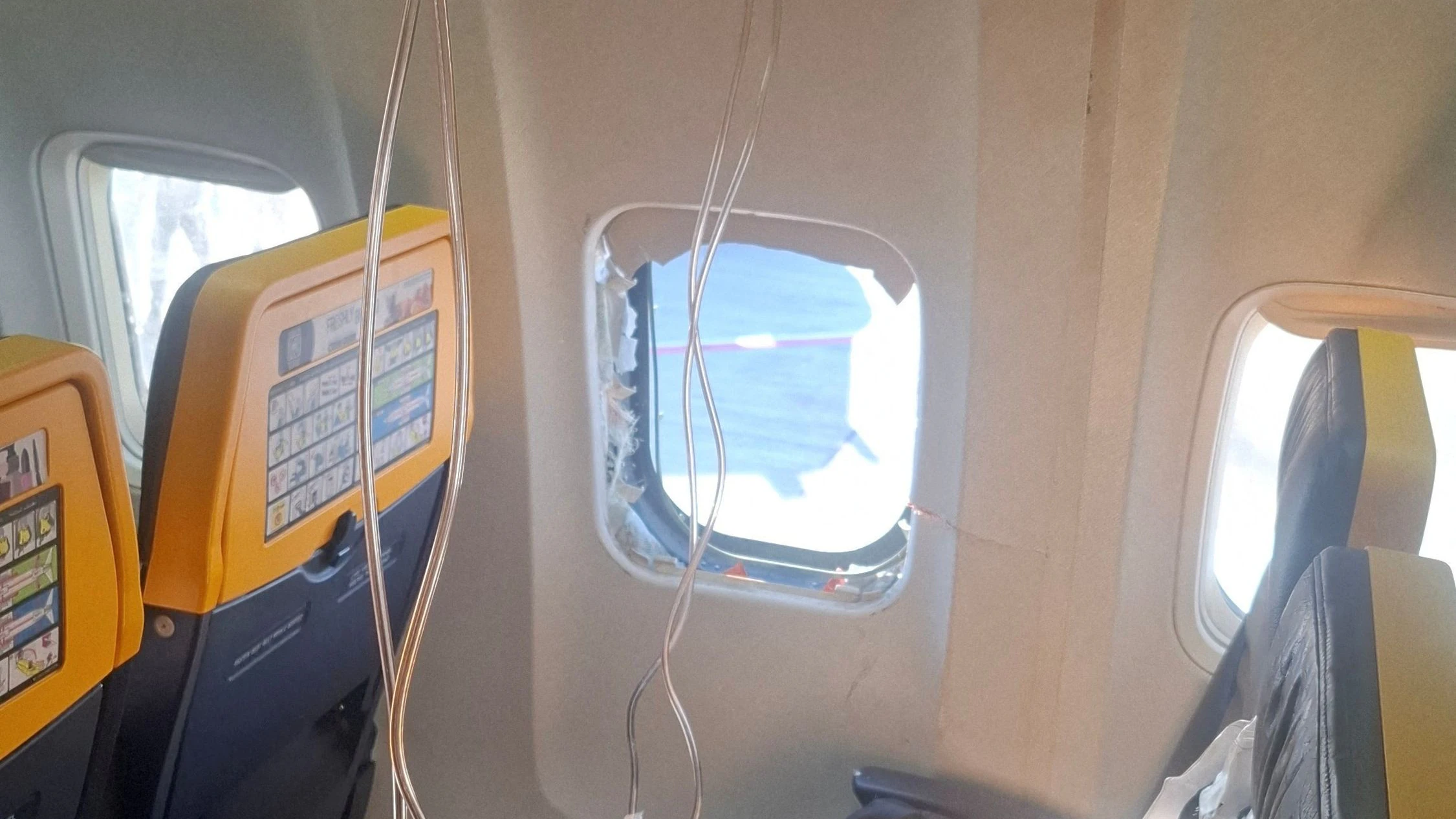 Heute.at - Gesicht deformiert – Mann aus Ryanair-Flieger gesaugt