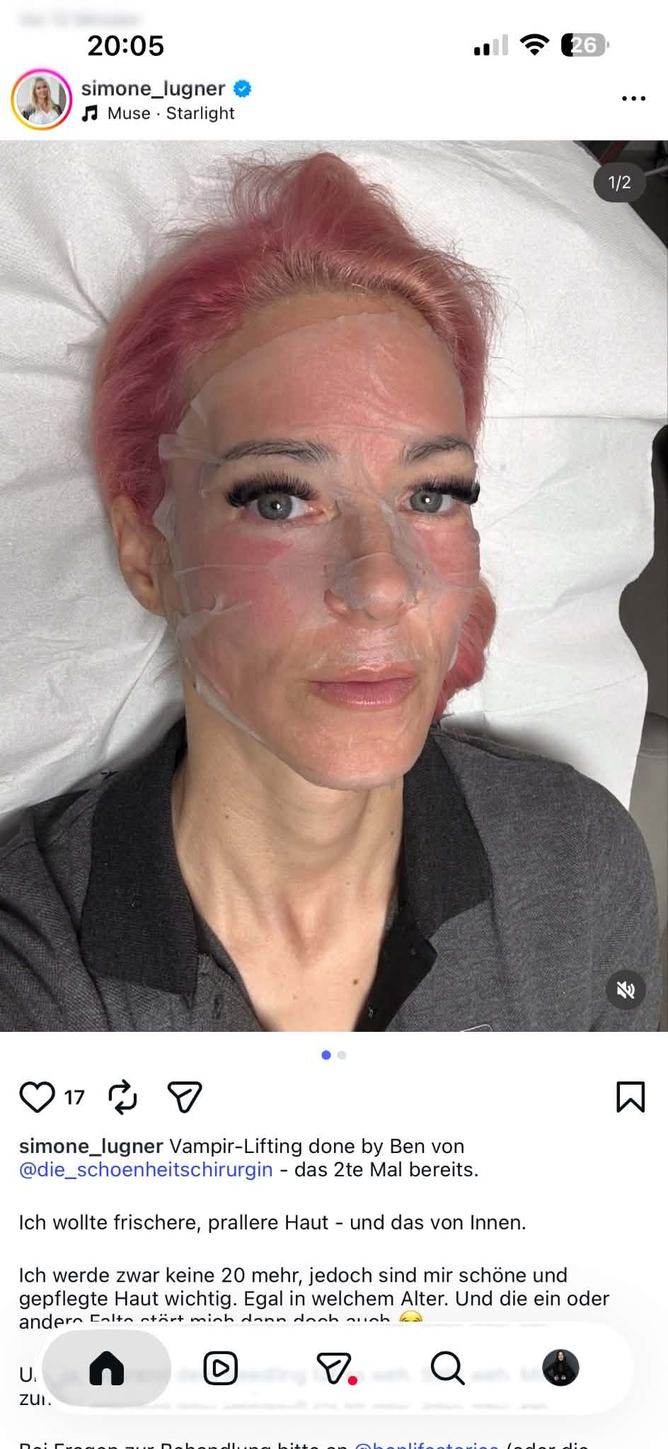 Simone Lugner nimmt ihre Follower zum Eingriff mit 