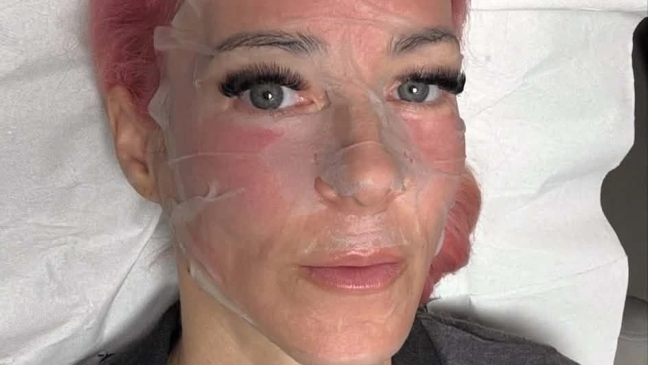 Heute.at - Blut fürs Beauty-Upgrade – Simone Lugner legt nach