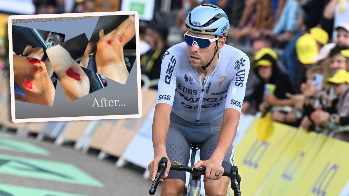 Xandro Meurisse wurde nach dem Tour-Einzelzeitfahren angefahren. 