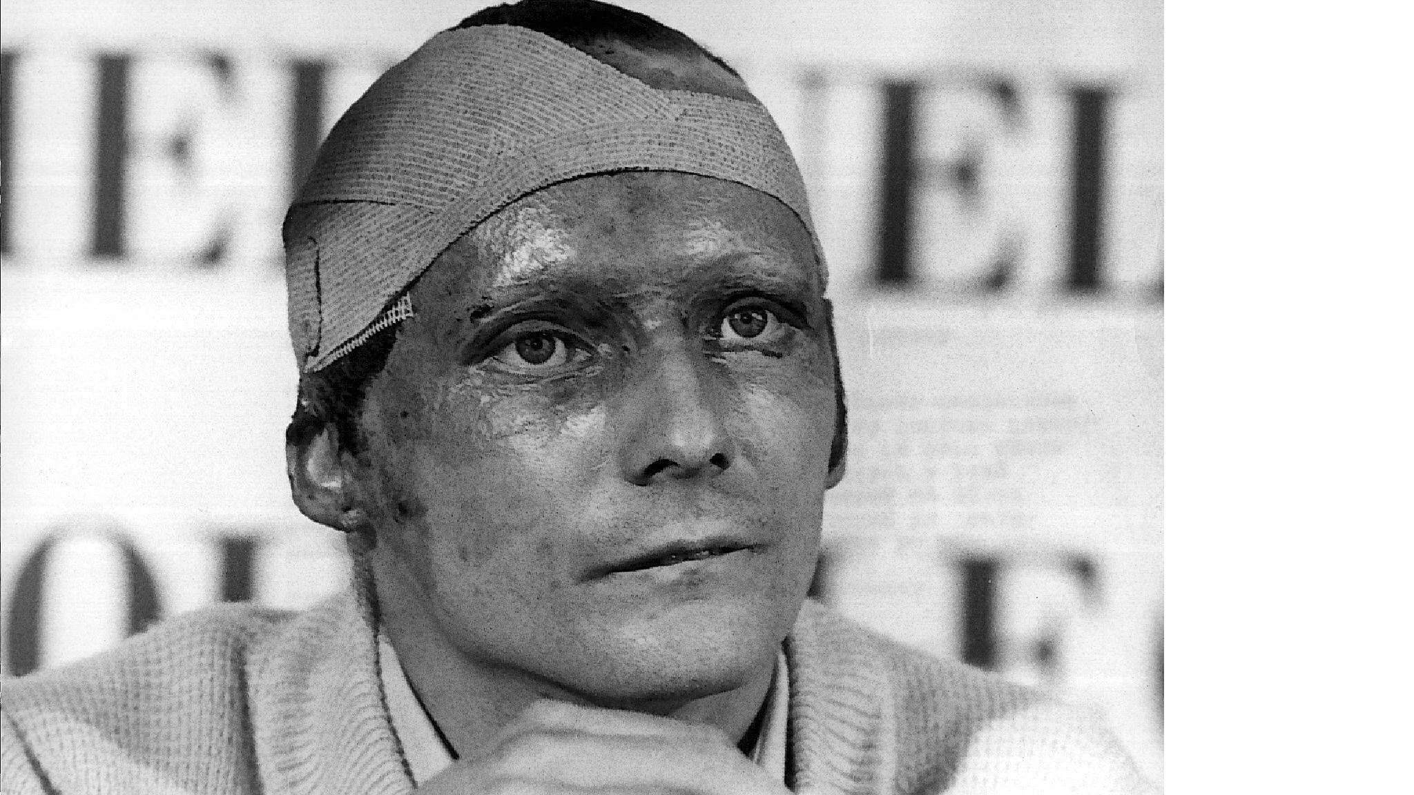 Niki Lauda bei einer Pressekonferenz nach dem langen Spitalsaufenthalt.