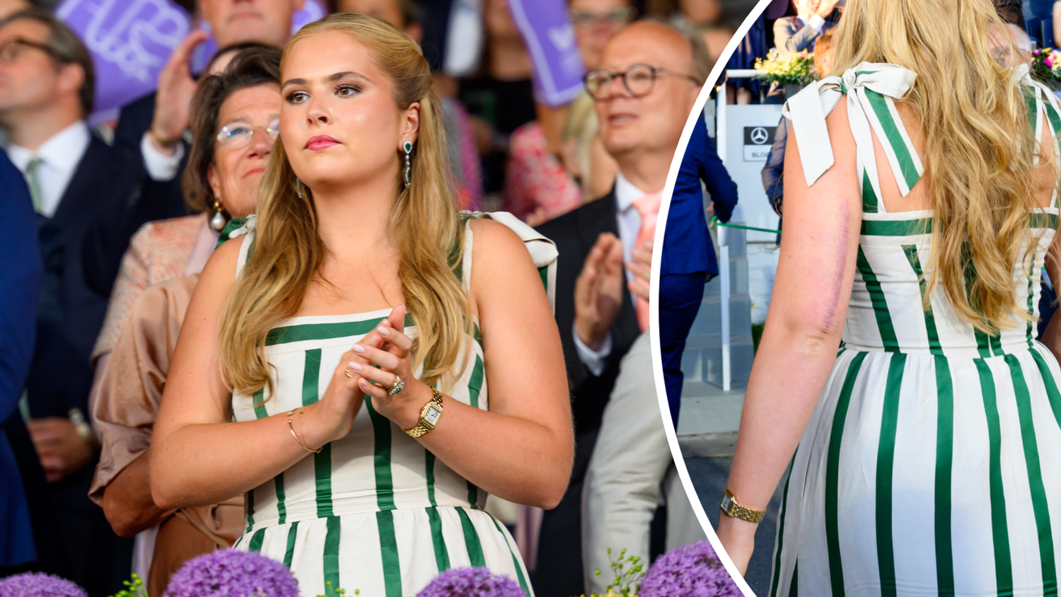 Prinzessin Amalia zeigt bei der Reit-WM in Aachen selbstbewusst ihre Narbe.