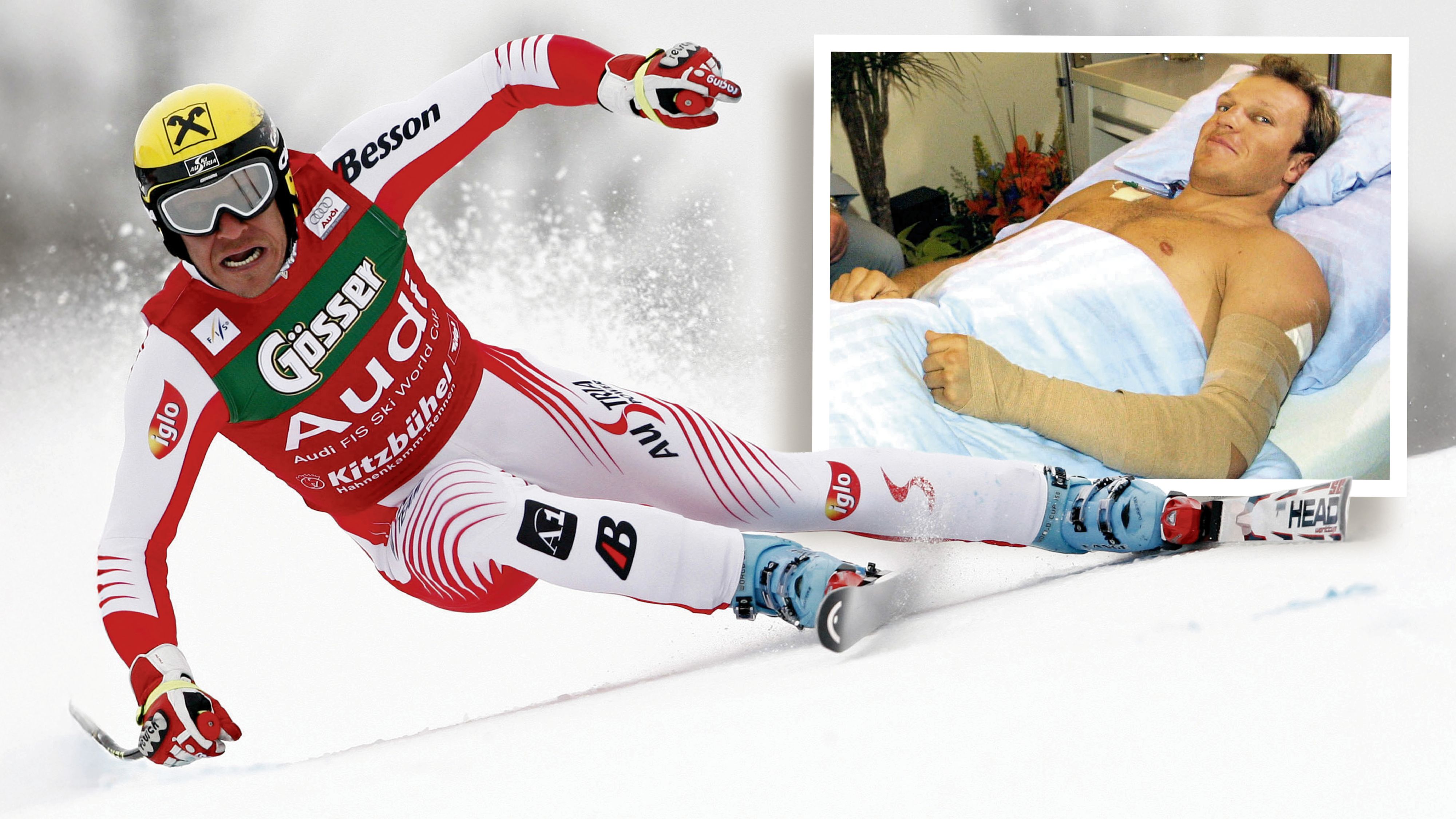 Ski-Ikone Hermann Maier verunglückte am 23. August 2001 mit dem Motorrad schwer. In der Klinik kämpften die Ärzte um sein Bein.