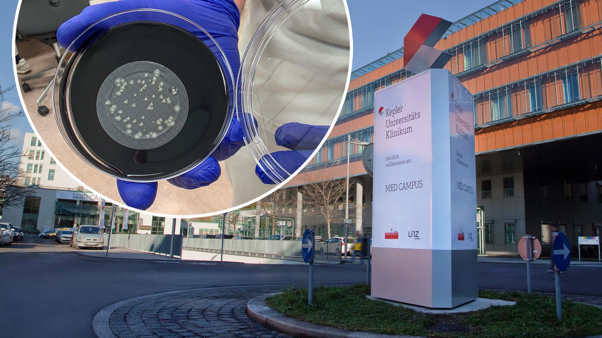 Allein im KUK wurden 15 Betroffene versorgt, zwei starben dort im Zusammenhang mit der Infektion.