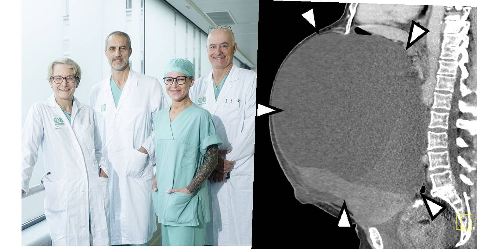 Das Ärzteteam entfernte den Tumor.